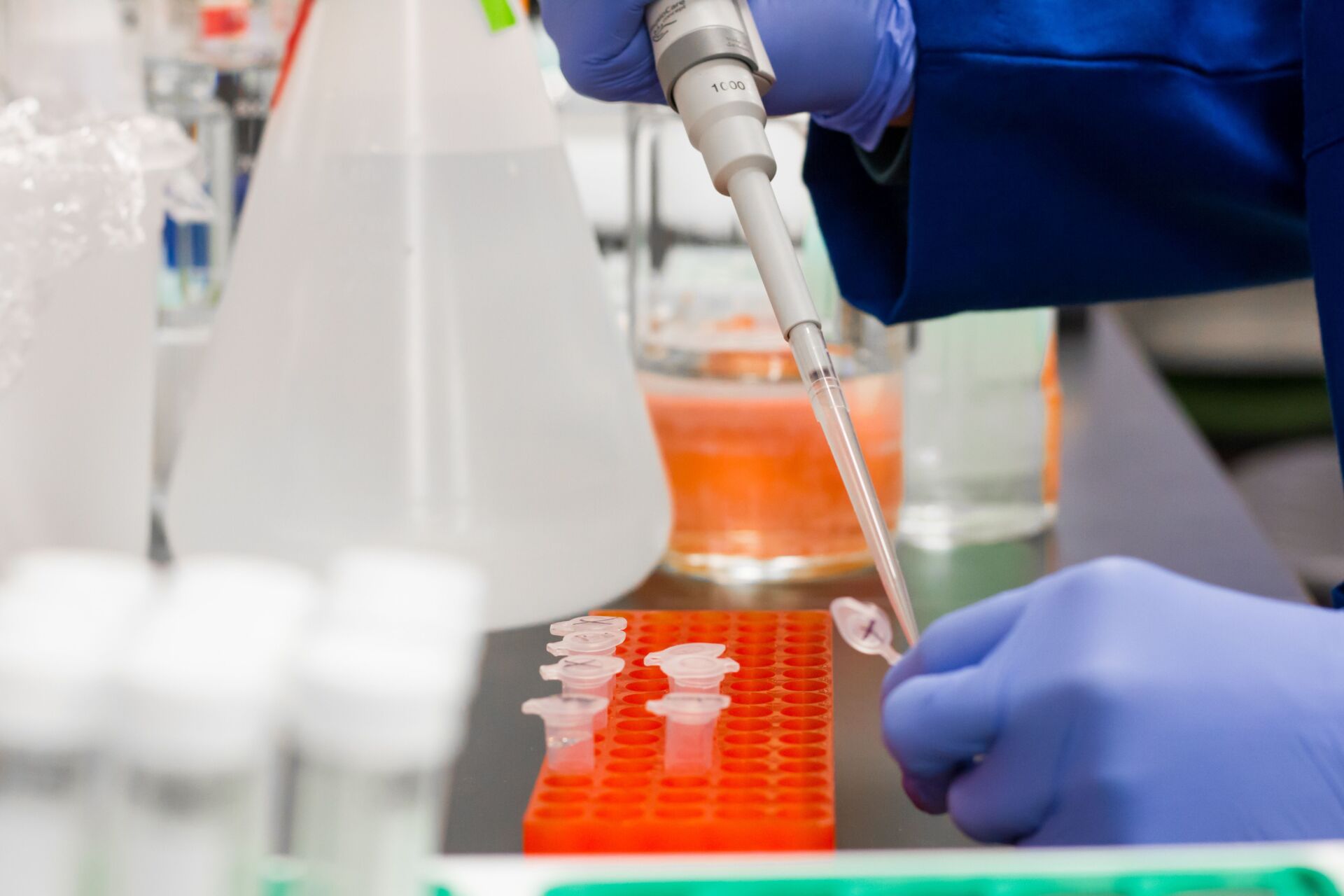 Laboratórne testovanie vzorky pomocou pipety